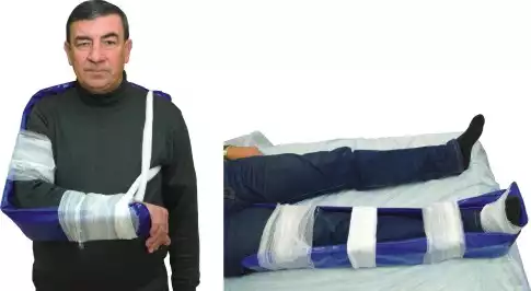 Комплект шин транспортных лестничных КШТЛ МП-01 (одинарный)